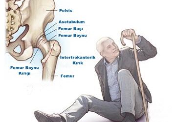 Kalça Kırığı Ameliyatı Sonrası Evde Fizik Tedavinin Sistematik İncelenmesi